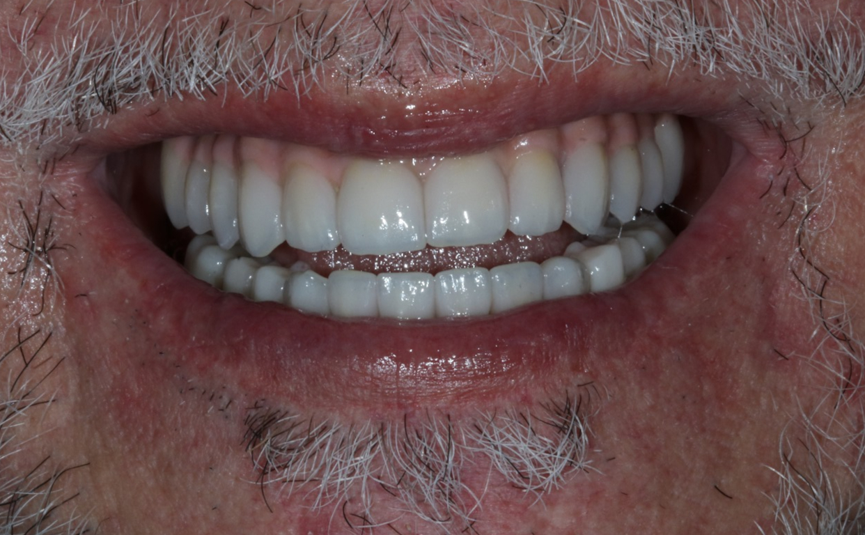 Imagem sobre a barbearia